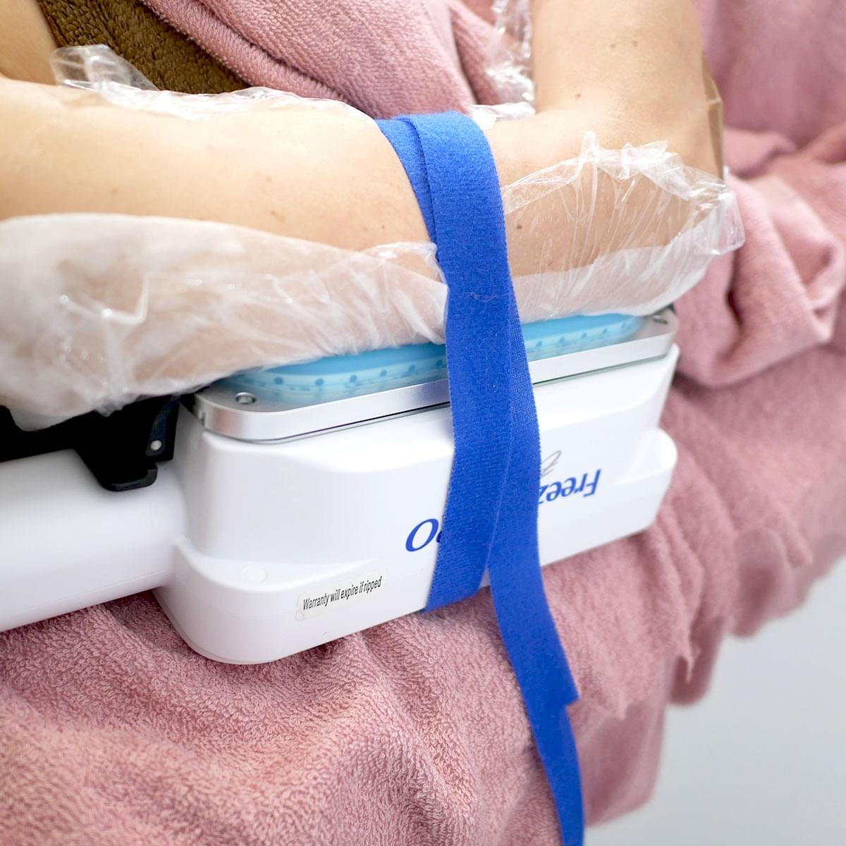 脂肪冷却で二の腕を引き締める施術シーン