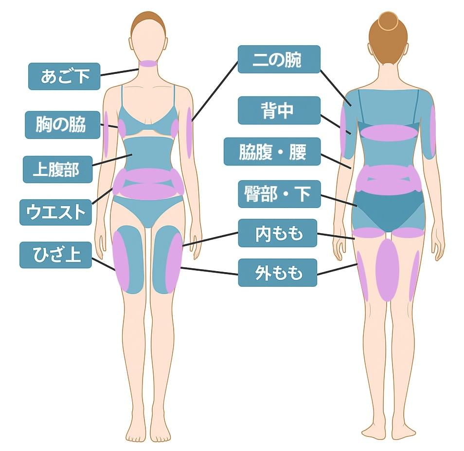 脂肪冷却ができる適応部位表