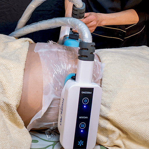 脂肪冷却で二の腕を引き締める施術シーン